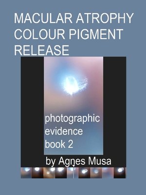 cover image of Macular Atrophy Colour Pigment Release, Photographic Evidence Book 2